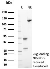 HLA-G (Major Histocompatibility Complex, class I, G) Antibody in SDS-PAGE (SDS-PAGE)