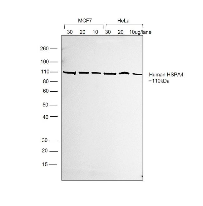 Human IgG (H+L) Cross-Adsorbed Secondary Antibody in Western Blot (WB)
