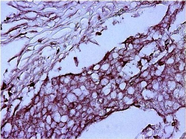 Mouse IgG (H+L) Secondary Antibody in Immunohistochemistry (Paraffin) (IHC (P))