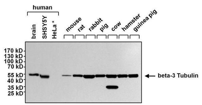 Mouse IgG (H+L) Secondary Antibody in Western Blot (WB)