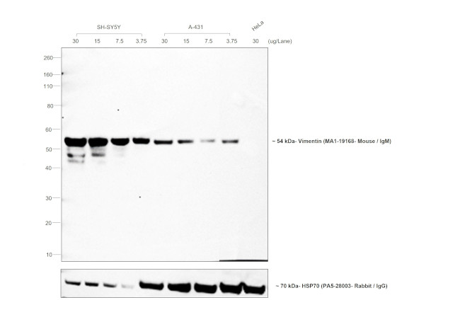 Mouse IgM Secondary Antibody in Western Blot (WB)