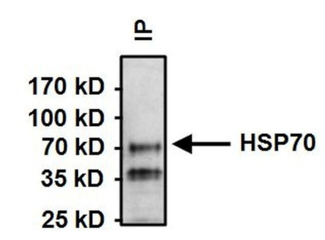 Mouse IgM Secondary Antibody in Immunoprecipitation (IP)