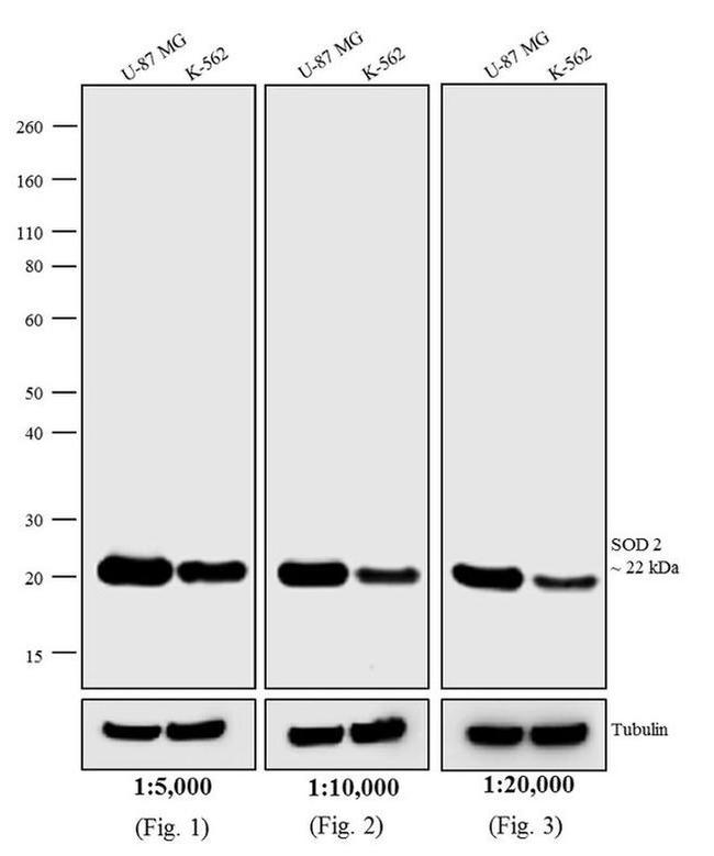 Mouse IgG, IgM (H+L) Secondary Antibody in Western Blot (WB)