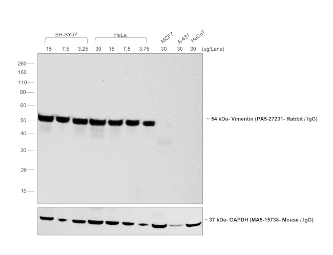 Rabbit IgG (H+L) Cross-Adsorbed Secondary Antibody in Western Blot (WB)