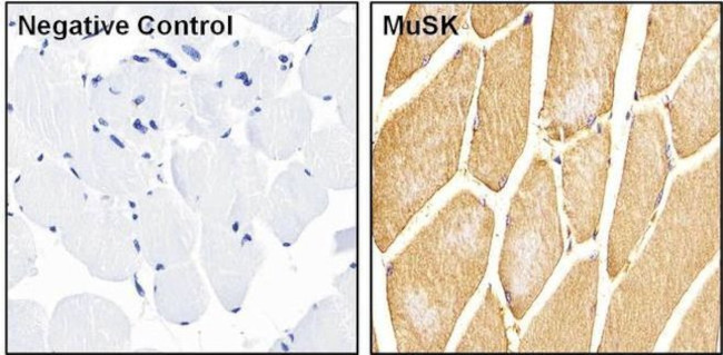 Rabbit IgG (H+L) Secondary Antibody in Immunohistochemistry (Paraffin) (IHC (P))