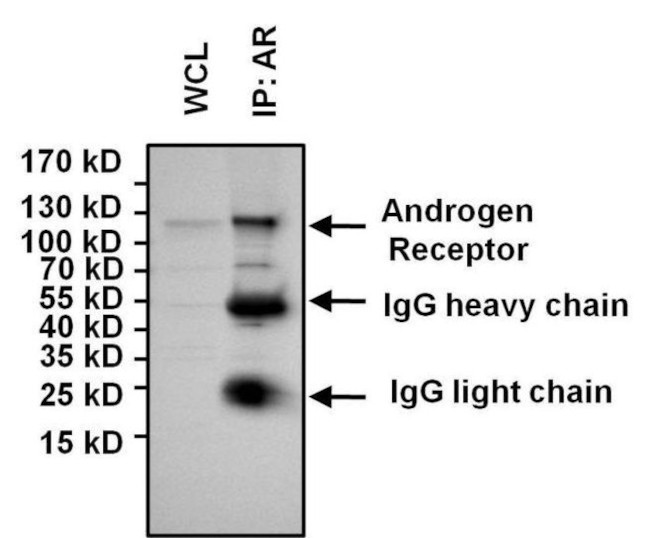 Rabbit IgG (H+L) Secondary Antibody in Immunoprecipitation (IP)