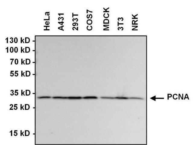 Rabbit IgG (H+L) Secondary Antibody in Western Blot (WB)