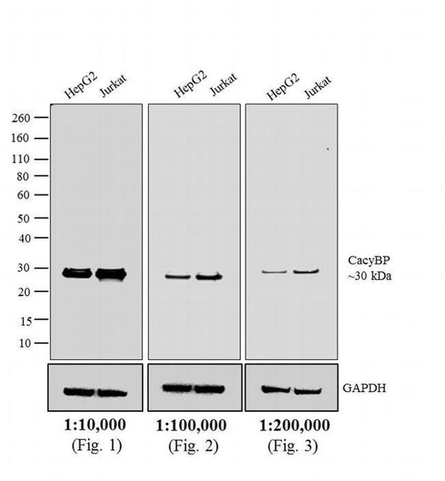 Rabbit IgG (H+L) Cross-Adsorbed Secondary Antibody in Western Blot (WB)