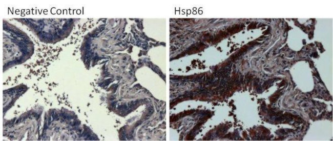 Rabbit IgG (H+L) Secondary Antibody in Immunohistochemistry (Paraffin) (IHC (P))