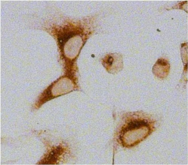 Rat IgG (H+L) Secondary Antibody in Immunocytochemistry (ICC/IF)