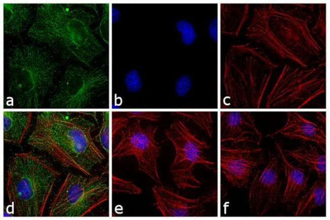 Mouse IgG (H+L) Cross-Adsorbed Secondary Antibody in Immunocytochemistry (ICC/IF)