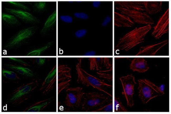 Rabbit IgG (H+L) Cross-Adsorbed Secondary Antibody in Immunocytochemistry (ICC/IF)