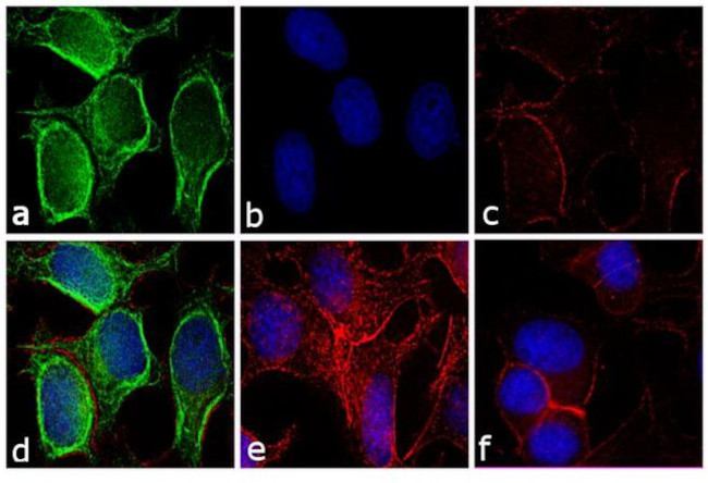 Mouse IgG (H+L) Secondary Antibody in Immunocytochemistry (ICC/IF)