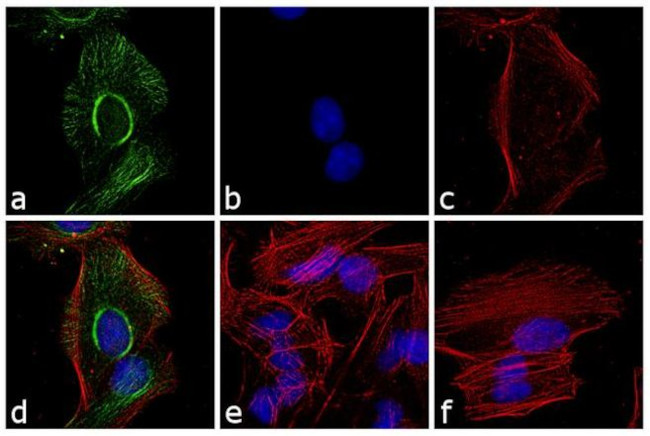 Rabbit IgG F(ab')2 Secondary Antibody in Immunocytochemistry (ICC/IF)