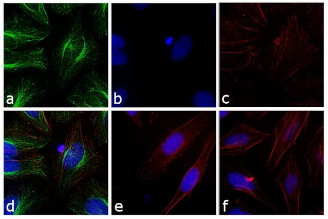 Rabbit IgG (H+L) Secondary Antibody in Immunocytochemistry (ICC/IF)