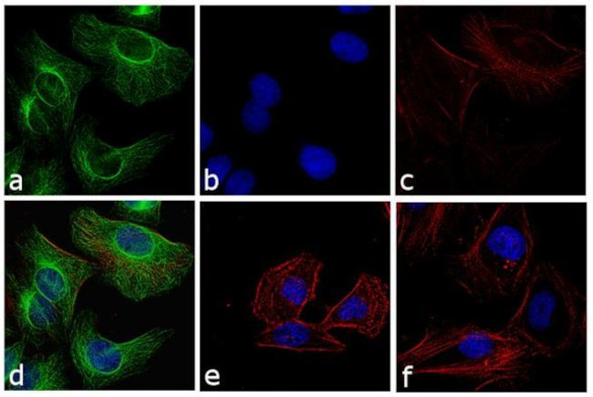 Rabbit IgG (H+L) Cross-Adsorbed Secondary Antibody in Immunocytochemistry (ICC/IF)