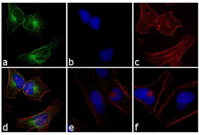 Rabbit IgG (H+L) Cross-Adsorbed Secondary Antibody in Immunocytochemistry (ICC/IF)