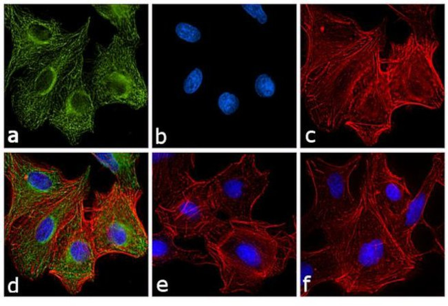 Rat IgG Fc Secondary Antibody in Immunocytochemistry (ICC/IF)