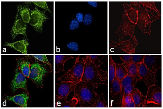 Mouse IgG2a Cross-Adsorbed Secondary Antibody in Immunocytochemistry (ICC/IF)