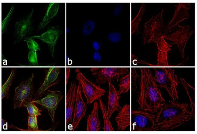 Rabbit IgG (H+L) Secondary Antibody in Immunocytochemistry (ICC/IF)