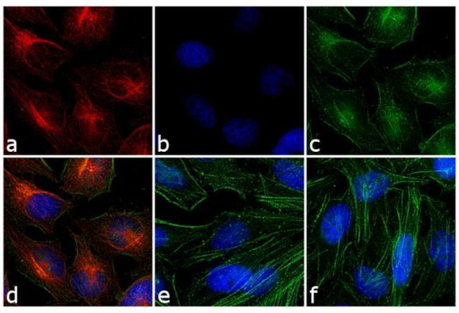 Mouse IgG (H+L) Secondary Antibody in Immunocytochemistry (ICC/IF)