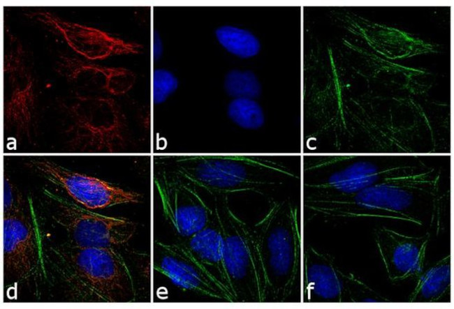 Mouse IgG (H+L) Cross-Adsorbed Secondary Antibody in Immunocytochemistry (ICC/IF)