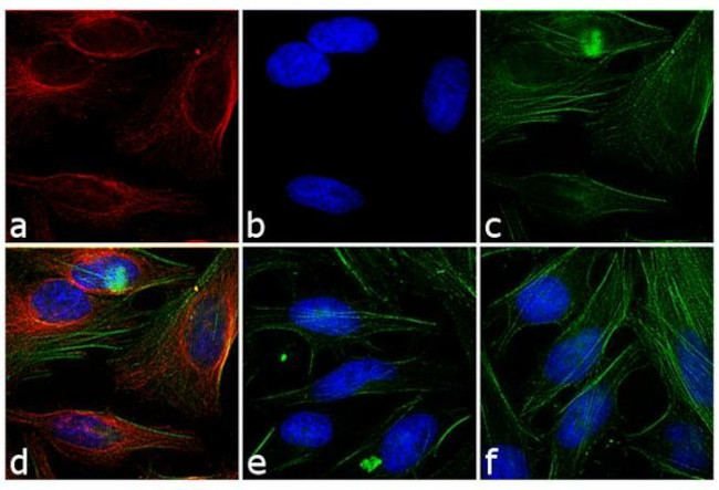 Mouse IgG Fc Secondary Antibody in Immunocytochemistry (ICC/IF)