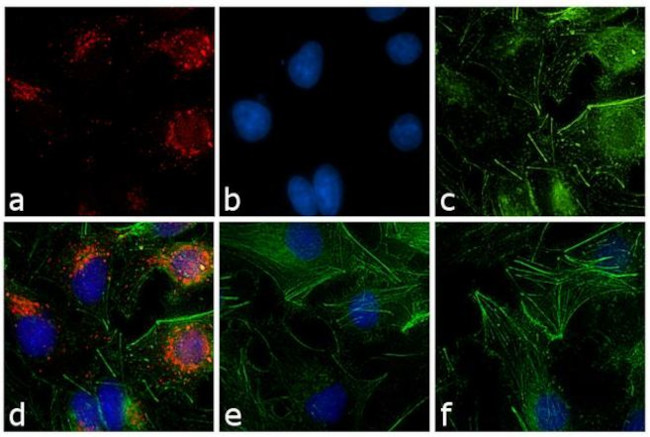 Rabbit IgG (H+L) Secondary Antibody in Immunocytochemistry (ICC/IF)