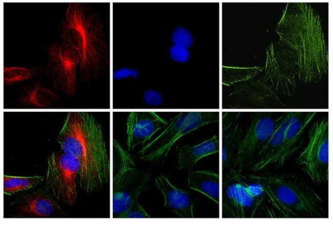 Rabbit IgG (H+L) Cross-Adsorbed Secondary Antibody in Immunocytochemistry (ICC/IF)