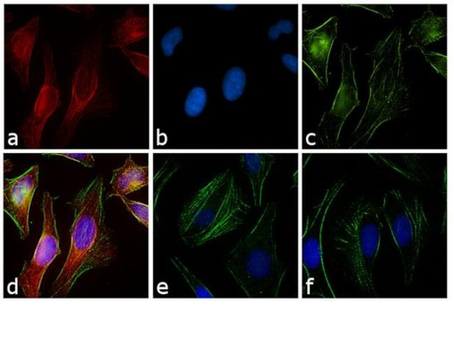 Rabbit IgG (H+L) Cross-Adsorbed Secondary Antibody in Immunocytochemistry (ICC/IF)