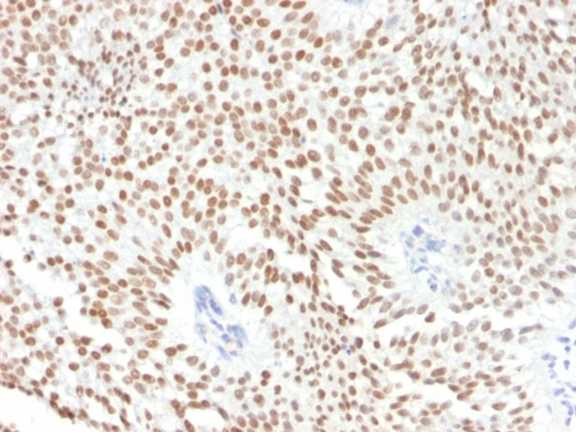 FOXA1/HNF3A Antibody in Immunohistochemistry (Paraffin) (IHC (P))