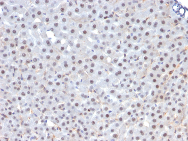 FOXA1/HNF3A Antibody in Immunohistochemistry (Paraffin) (IHC (P))