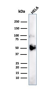 FOXA1/HNF3A Antibody in Western Blot (WB)