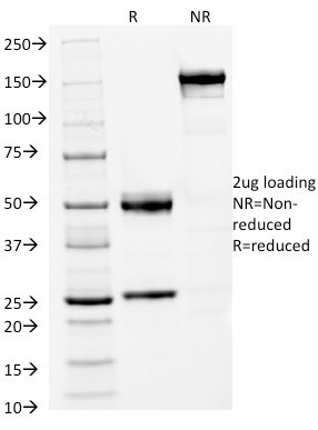 FOXA1/HNF3A Antibody in SDS-PAGE (SDS-PAGE)