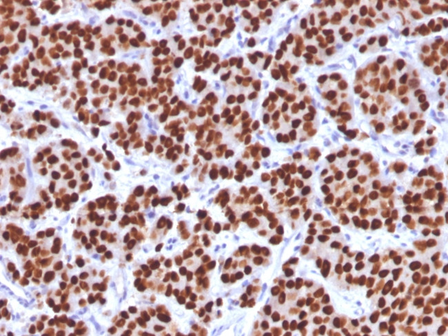 FOXA1/HNF3A Antibody in Immunohistochemistry (Paraffin) (IHC (P))