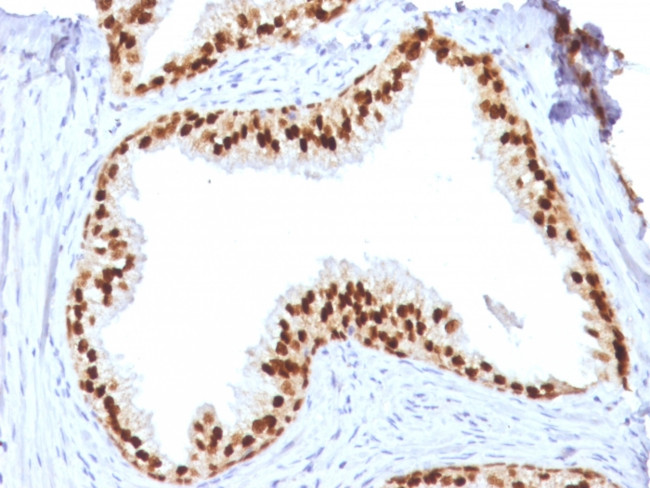 FOXA1/HNF3A Antibody in Immunohistochemistry (Paraffin) (IHC (P))