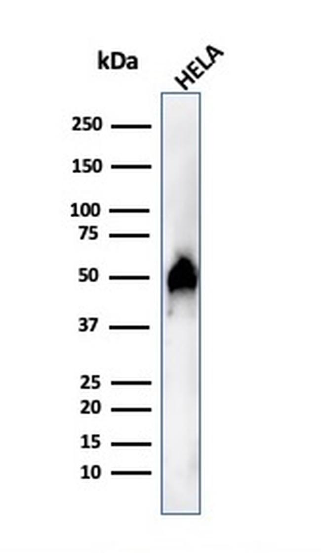 FOXA1/HNF3A Antibody in Western Blot (WB)