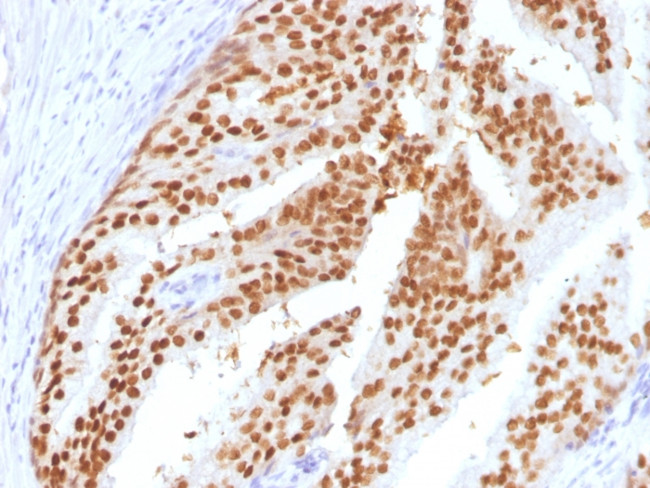 FOXA1/HNF3A Antibody in Immunohistochemistry (Paraffin) (IHC (P))