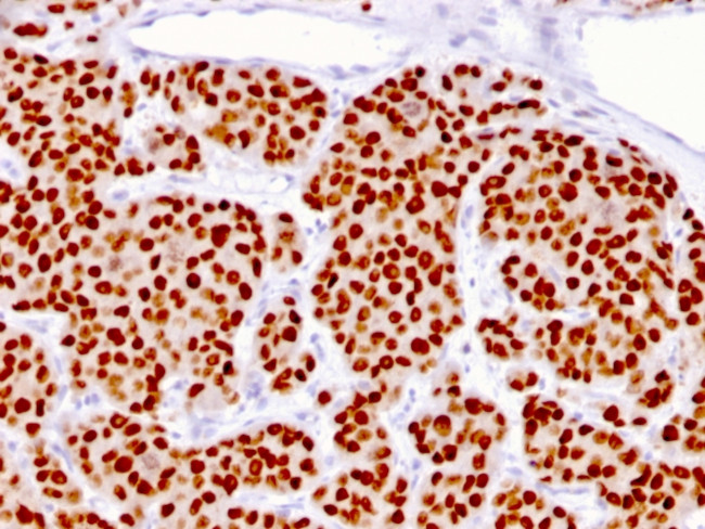 FOXA1/HNF3A Antibody in Immunohistochemistry (Paraffin) (IHC (P))