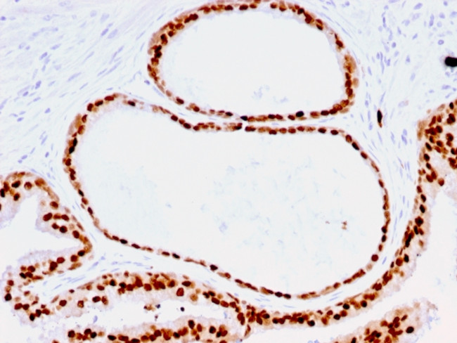 FOXA1/HNF3A Antibody in Immunohistochemistry (Paraffin) (IHC (P))