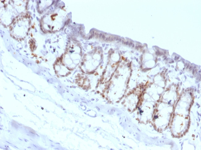 FOXA1/HNF3A Antibody in Immunohistochemistry (Paraffin) (IHC (P))