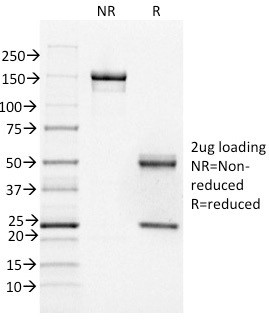 FOXA1/HNF3A Antibody in SDS-PAGE (SDS-PAGE)