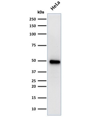 FOXA1/HNF3A Antibody in Western Blot (WB)