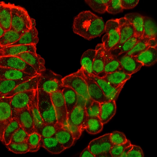 FOXA1/HNF3A Antibody in Immunocytochemistry (ICC/IF)