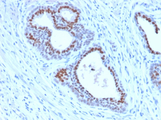 FOXA1/HNF3A Antibody in Immunohistochemistry (Paraffin) (IHC (P))