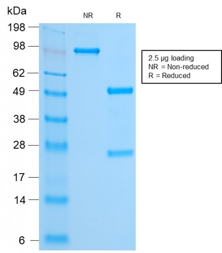 FOXA1/HNF3A Antibody in SDS-PAGE (SDS-PAGE)