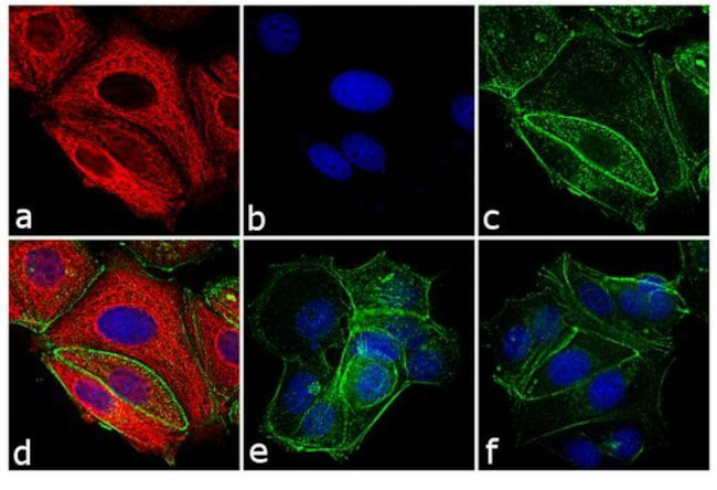 Mouse IgG Fc Cross-Adsorbed Secondary Antibody in Immunocytochemistry (ICC/IF)