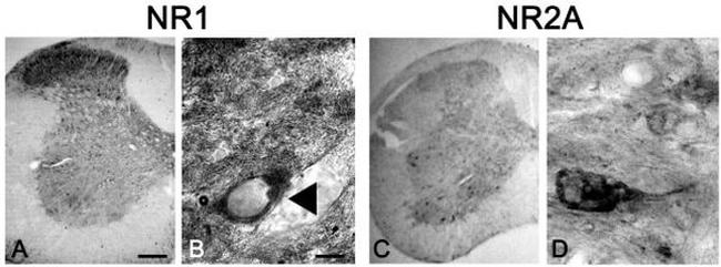 NMDAR1 Antibody in Immunohistochemistry (IHC)