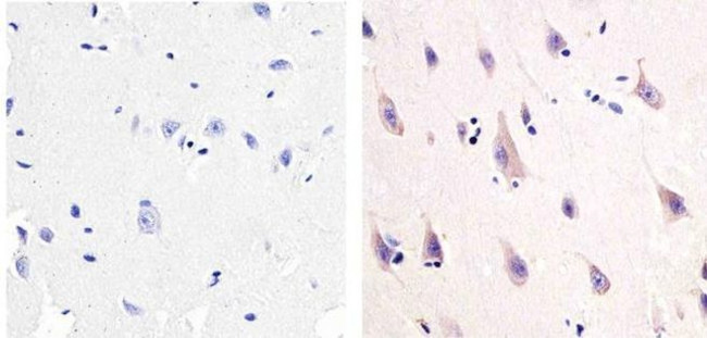 NMDAR1 Antibody in Immunohistochemistry (Paraffin) (IHC (P))