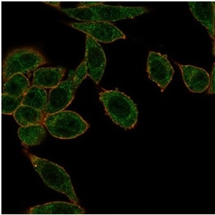 HOXB2 (Transcription Factor) Antibody in Immunocytochemistry (ICC/IF)